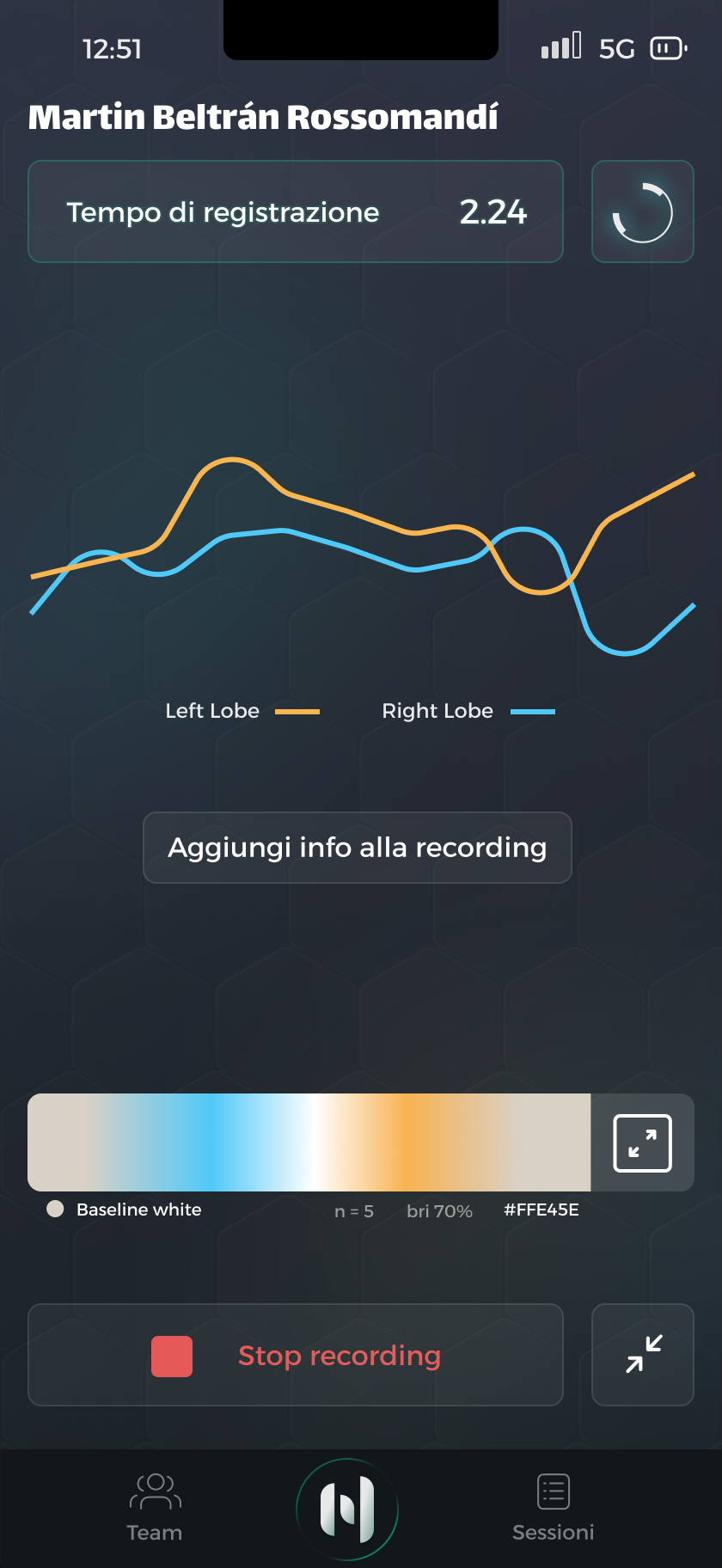 Holytics — sessione EEG live